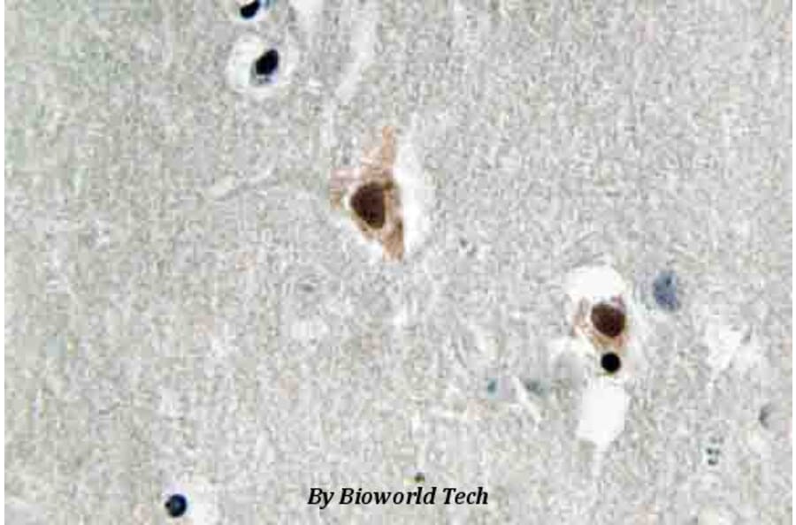 Anti-MEF-2C (I390) Antibody from Bioworld Technology (BS3767) - Antibodies.com