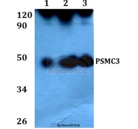 Anti-PSMC3 (V306) Antibody from Bioworld Technology (BS3778) - Antibodies.com