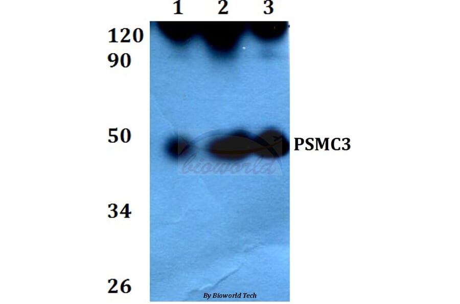 Anti-PSMC3 (V306) Antibody from Bioworld Technology (BS3778) - Antibodies.com