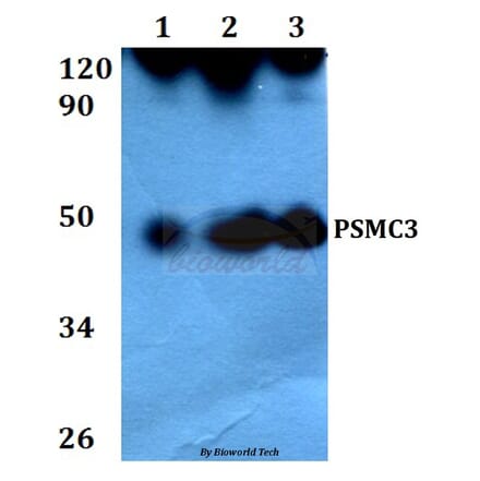 Anti-PSMC3 (V306) Antibody from Bioworld Technology (BS3778) - Antibodies.com