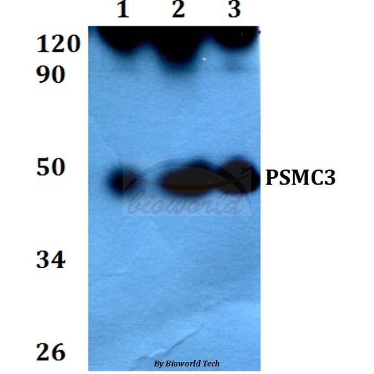 Anti-PSMC3 (V306) Antibody from Bioworld Technology (BS3778) - Antibodies.com