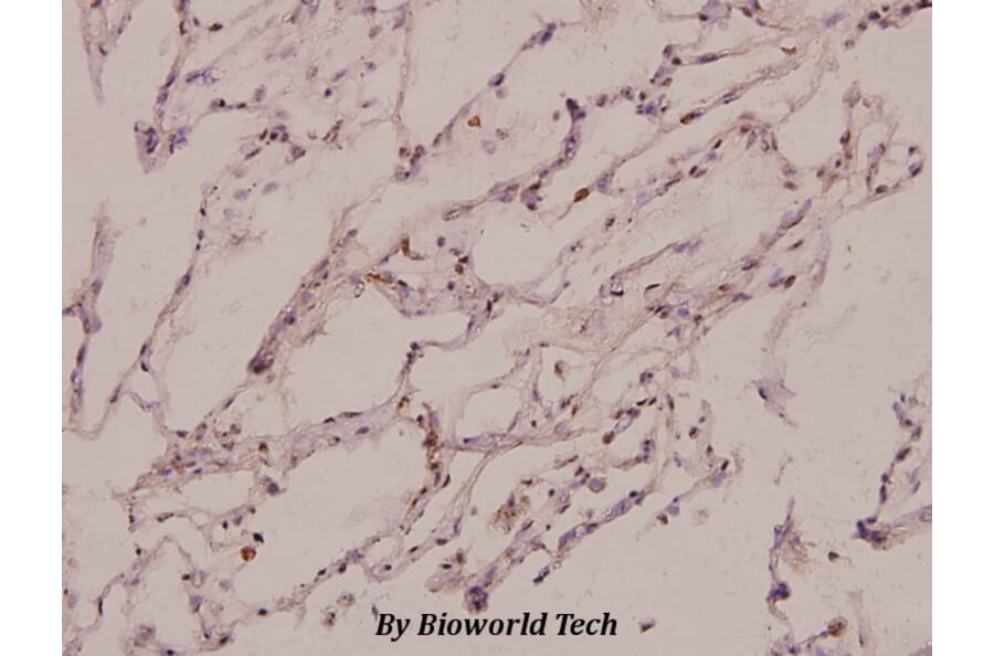 Anti-PSMC3 (V306) Antibody from Bioworld Technology (BS3778) - Antibodies.com