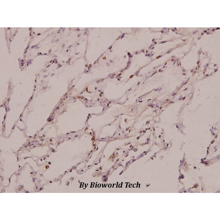 Anti-PSMC3 (V306) Antibody from Bioworld Technology (BS3778) - Antibodies.com