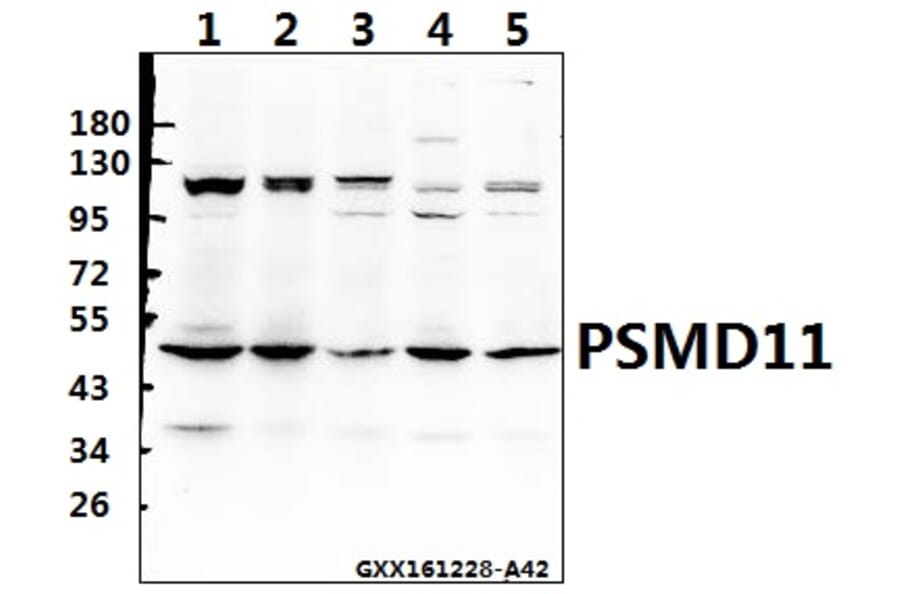Anti-PSMD11 (R310) Antibody from Bioworld Technology (BS3780) - Antibodies.com