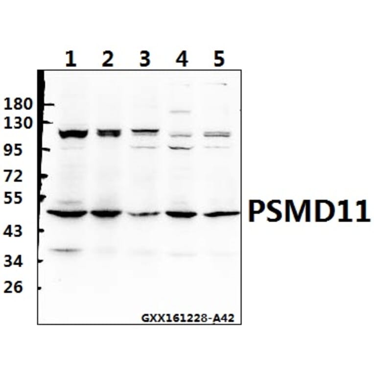 Anti-PSMD11 (R310) Antibody from Bioworld Technology (BS3780) - Antibodies.com