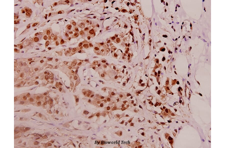 Anti-PSMD11 (R310) Antibody from Bioworld Technology (BS3780) - Antibodies.com
