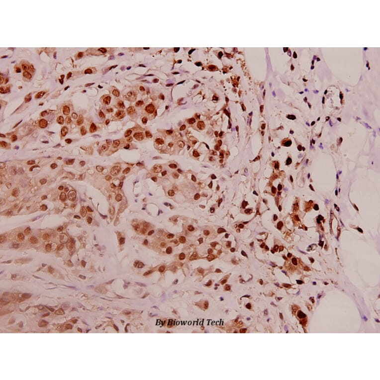 Anti-PSMD11 (R310) Antibody from Bioworld Technology (BS3780) - Antibodies.com