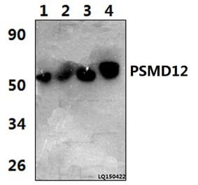 Anti-PSMD12 (I186) Antibody from Bioworld Technology (BS3781) - Antibodies.com