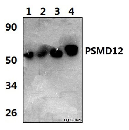 Anti-PSMD12 (I186) Antibody from Bioworld Technology (BS3781) - Antibodies.com