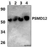 Anti-PSMD12 (I186) Antibody from Bioworld Technology (BS3781) - Antibodies.com