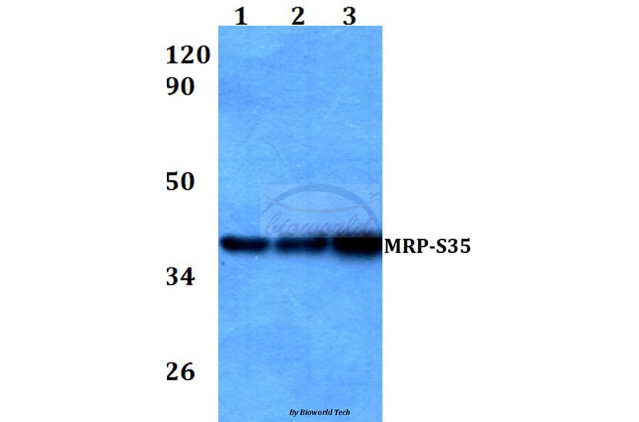 Anti-MRP-S35 (I252) Antibody from Bioworld Technology (BS3782) - Antibodies.com