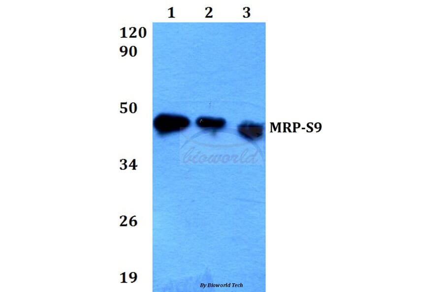 Anti-MRP-S9 (F132) Antibody from Bioworld Technology (BS3783) - Antibodies.com