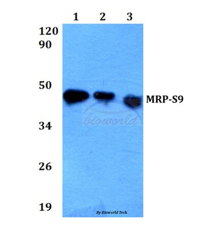 Anti-MRP-S9 (F132) Antibody from Bioworld Technology (BS3783) - Antibodies.com