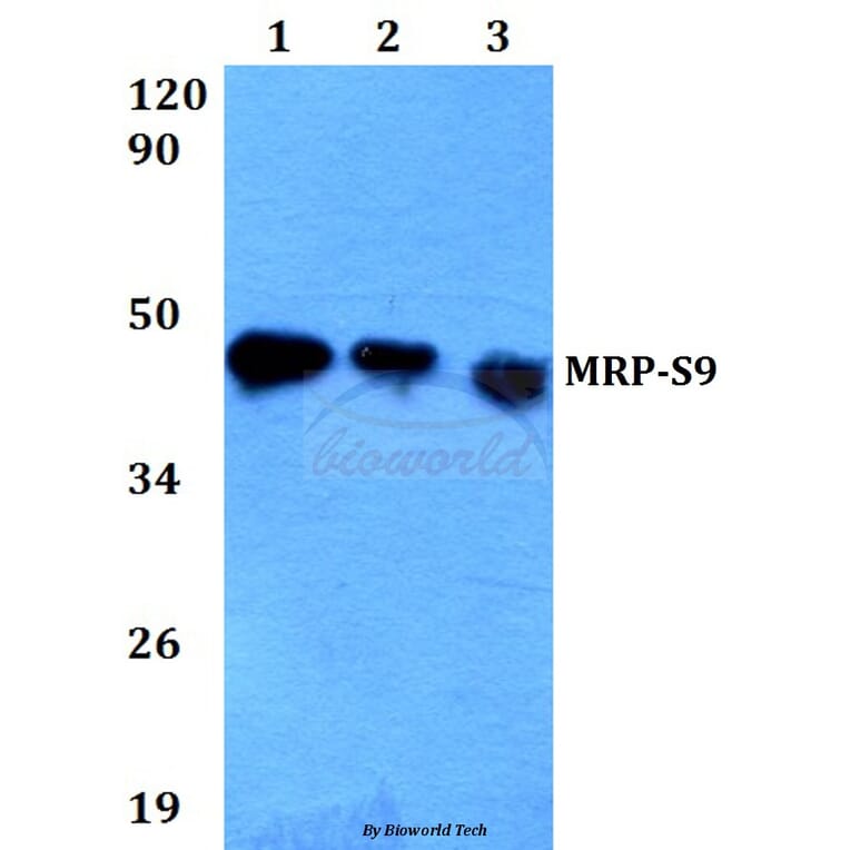 Anti-MRP-S9 (F132) Antibody from Bioworld Technology (BS3783) - Antibodies.com