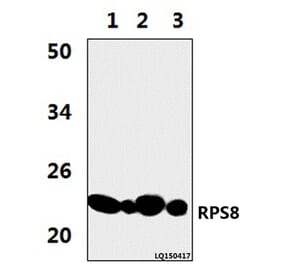 Anti-RPS8 (R152) Antibody from Bioworld Technology (BS3787) - Antibodies.com