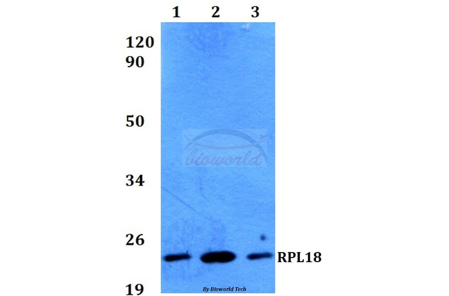 Anti-RPL18 (H151) Antibody from Bioworld Technology (BS3788) - Antibodies.com