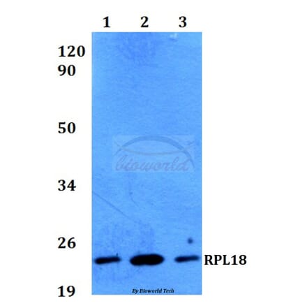 Anti-RPL18 (H151) Antibody from Bioworld Technology (BS3788) - Antibodies.com