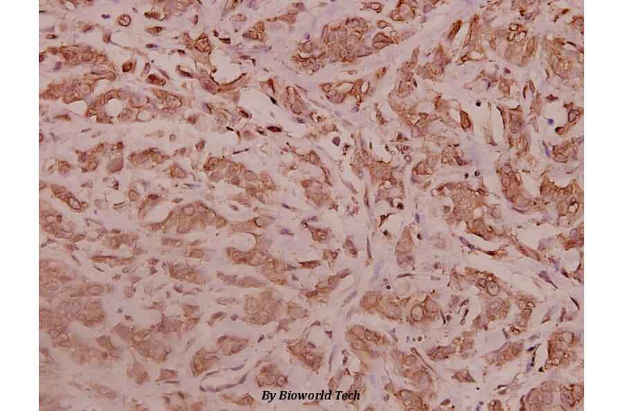 Anti-RPL28 (Y77) Antibody from Bioworld Technology (BS3790) - Antibodies.com