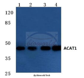 Anti-ACAT1 (K266) Antibody from Bioworld Technology (BS3796) - Antibodies.com