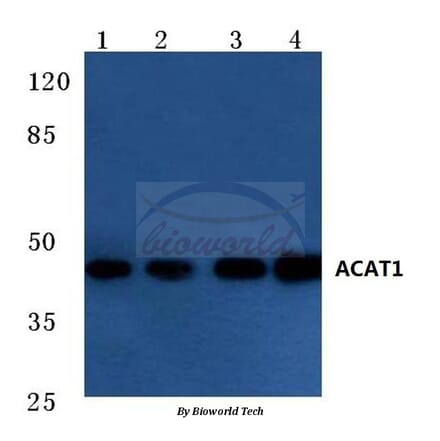 Anti-ACAT1 (K266) Antibody from Bioworld Technology (BS3796) - Antibodies.com