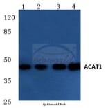 Anti-ACAT1 (K266) Antibody from Bioworld Technology (BS3796) - Antibodies.com