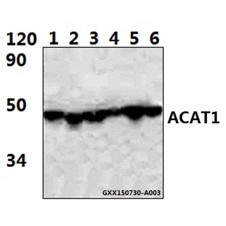 Anti-ACAT1 (K266) Antibody from Bioworld Technology (BS3796) - Antibodies.com