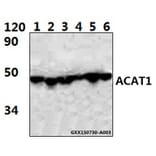 Anti-ACAT1 (K266) Antibody from Bioworld Technology (BS3796) - Antibodies.com