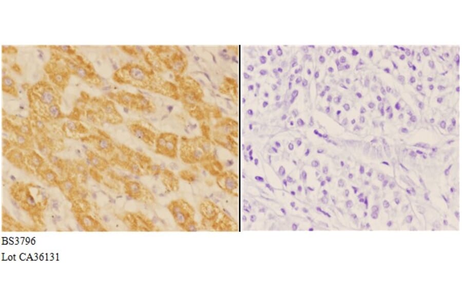 Anti-ACAT1 (K266) Antibody from Bioworld Technology (BS3796) - Antibodies.com