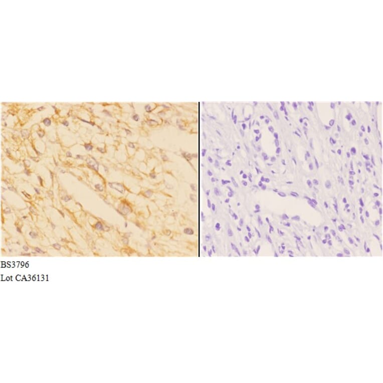 Anti-ACAT1 (K266) Antibody from Bioworld Technology (BS3796) - Antibodies.com