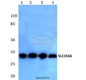 Anti-SLC25A6 (R155) Antibody from Bioworld Technology (BS3799) - Antibodies.com