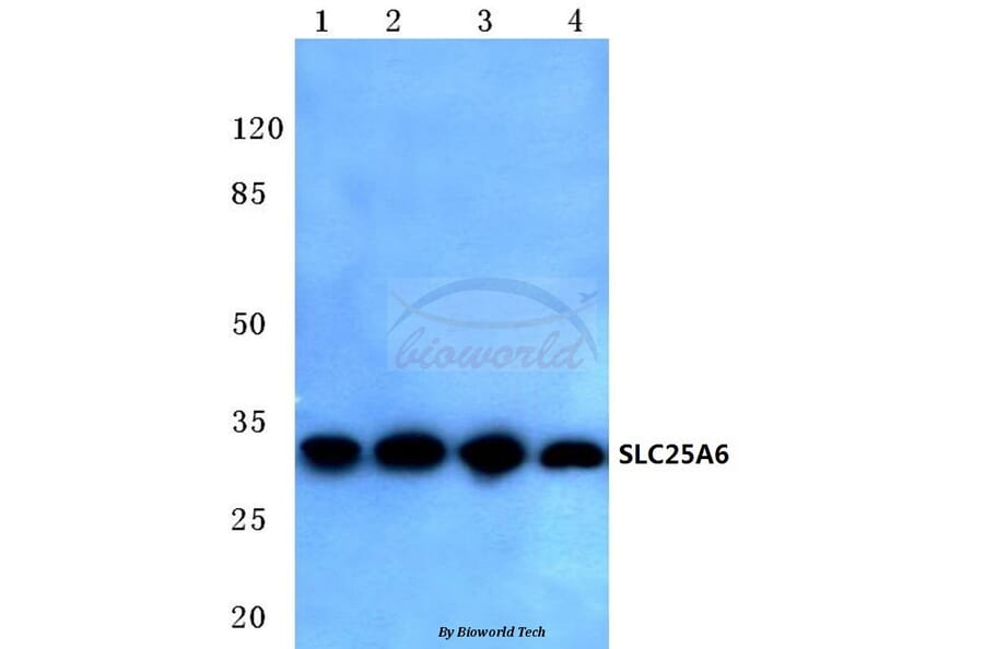Anti-SLC25A6 (R155) Antibody from Bioworld Technology (BS3799) - Antibodies.com