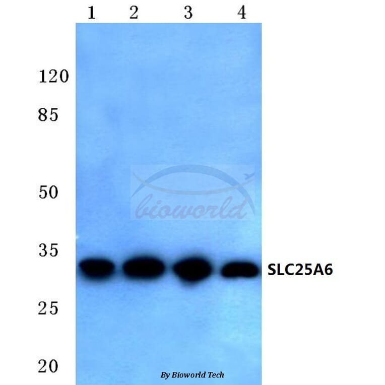 Anti-SLC25A6 (R155) Antibody from Bioworld Technology (BS3799) - Antibodies.com