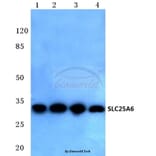 Anti-SLC25A6 (R155) Antibody from Bioworld Technology (BS3799) - Antibodies.com