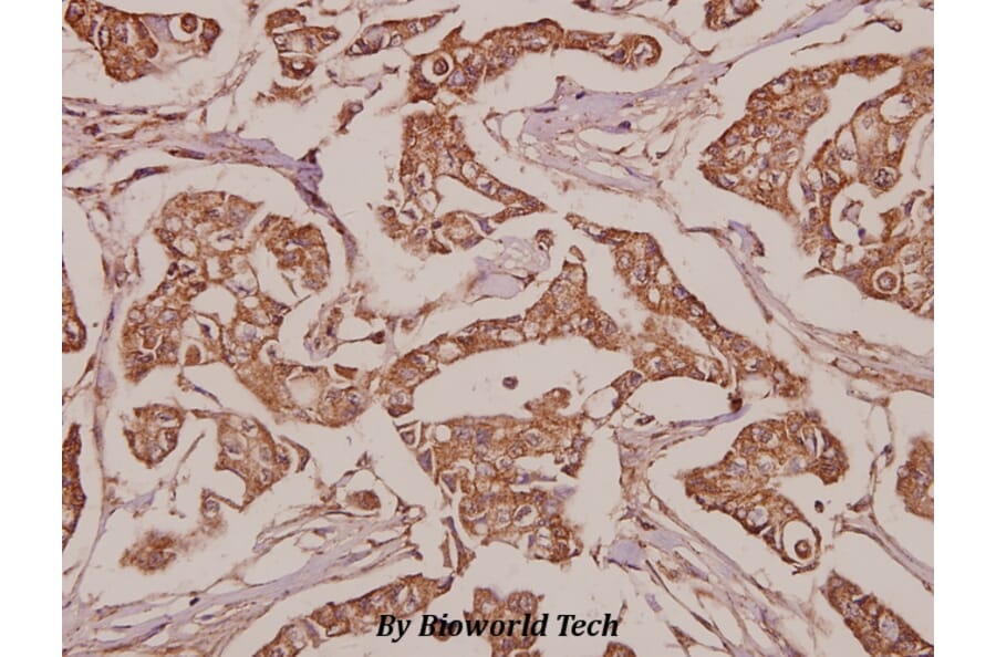 Anti-SLC25A6 (R155) Antibody from Bioworld Technology (BS3799) - Antibodies.com