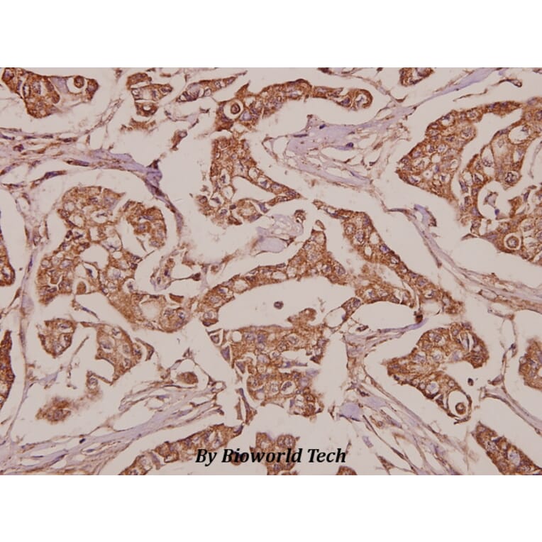Anti-SLC25A6 (R155) Antibody from Bioworld Technology (BS3799) - Antibodies.com