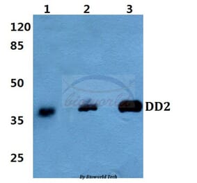 Anti-DD2 (Q60) Antibody from Bioworld Technology (BS3804) - Antibodies.com