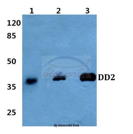 Anti-DD2 (Q60) Antibody from Bioworld Technology (BS3804) - Antibodies.com