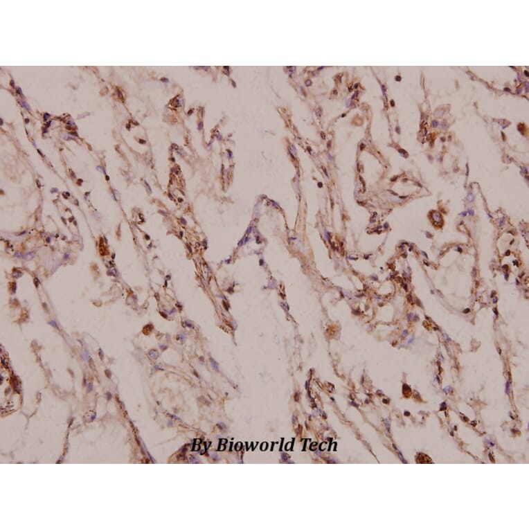 Anti-X11γ (R401) Antibody from Bioworld Technology (BS3806) - Antibodies.com