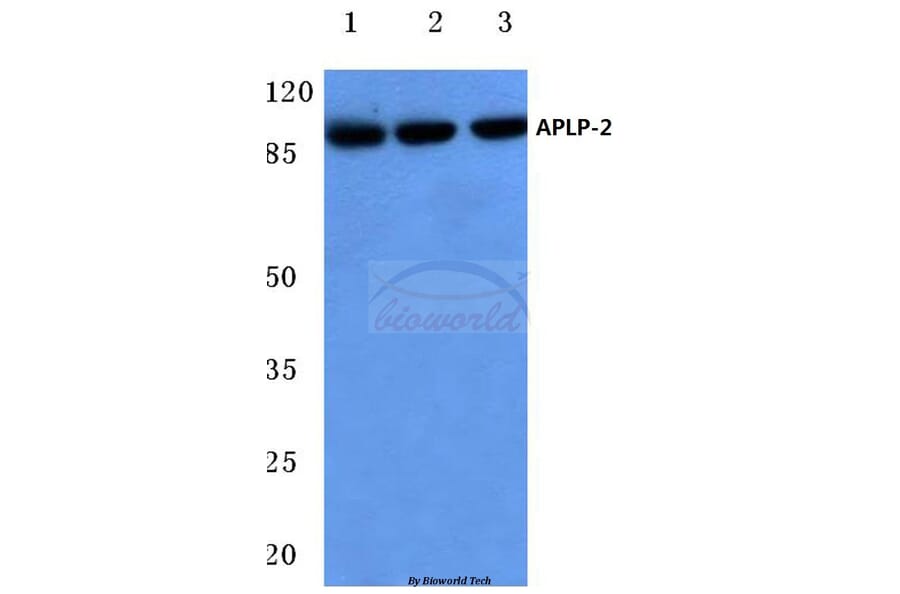 Anti-APLP-2 (Y274) Antibody from Bioworld Technology (BS3808) - Antibodies.com