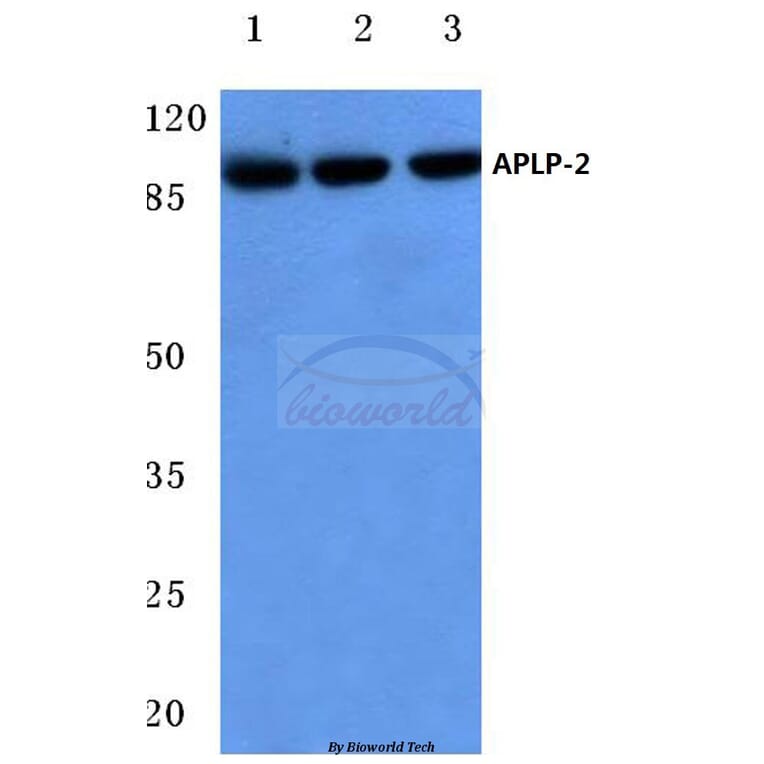 Anti-APLP-2 (Y274) Antibody from Bioworld Technology (BS3808) - Antibodies.com