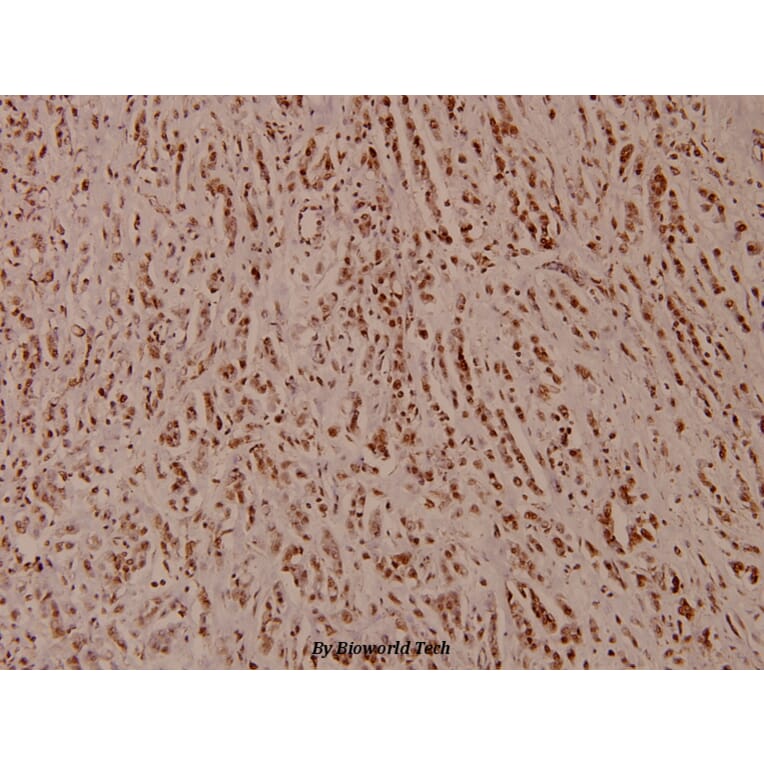 Anti-ATP5H (D146) Antibody from Bioworld Technology (BS3812) - Antibodies.com