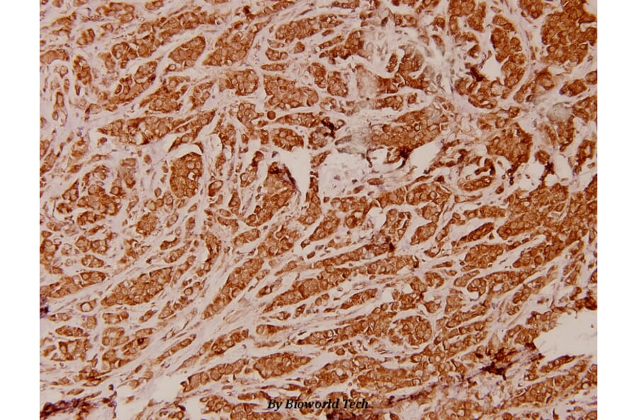 Anti-ATP5I (K69) Antibody from Bioworld Technology (BS3813) - Antibodies.com