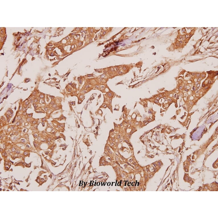 Anti-ATP5A (K239) Antibody from Bioworld Technology (BS3814) - Antibodies.com