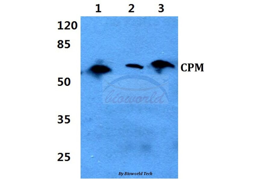 Anti-CPM (L113) Antibody from Bioworld Technology (BS3827) - Antibodies.com