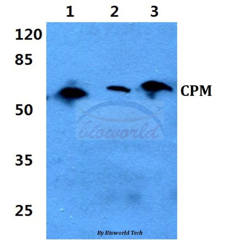 Anti-CPM (L113) Antibody from Bioworld Technology (BS3827) - Antibodies.com