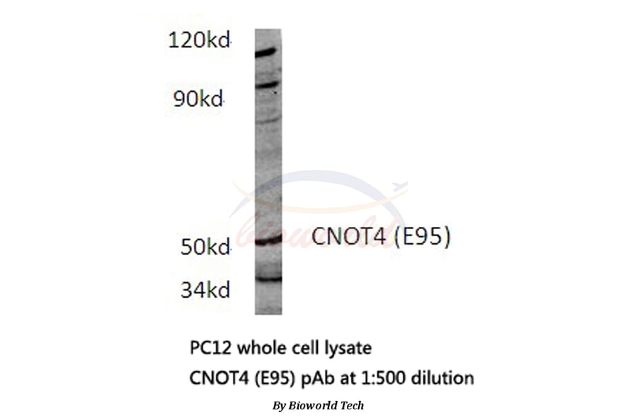Anti-CNOT4 (E95) Antibody from Bioworld Technology (BS3829) - Antibodies.com