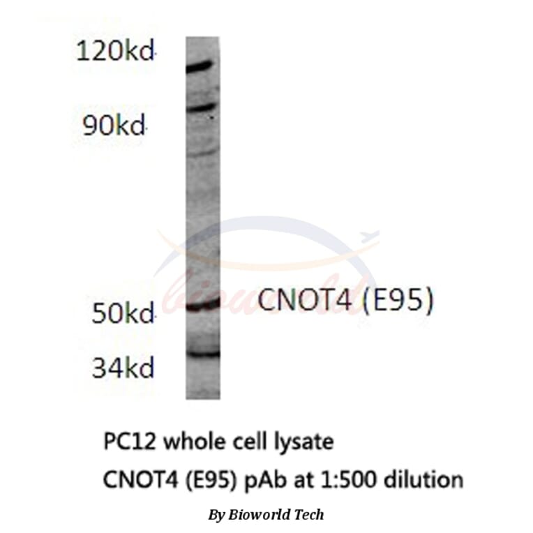Anti-CNOT4 (E95) Antibody from Bioworld Technology (BS3829) - Antibodies.com