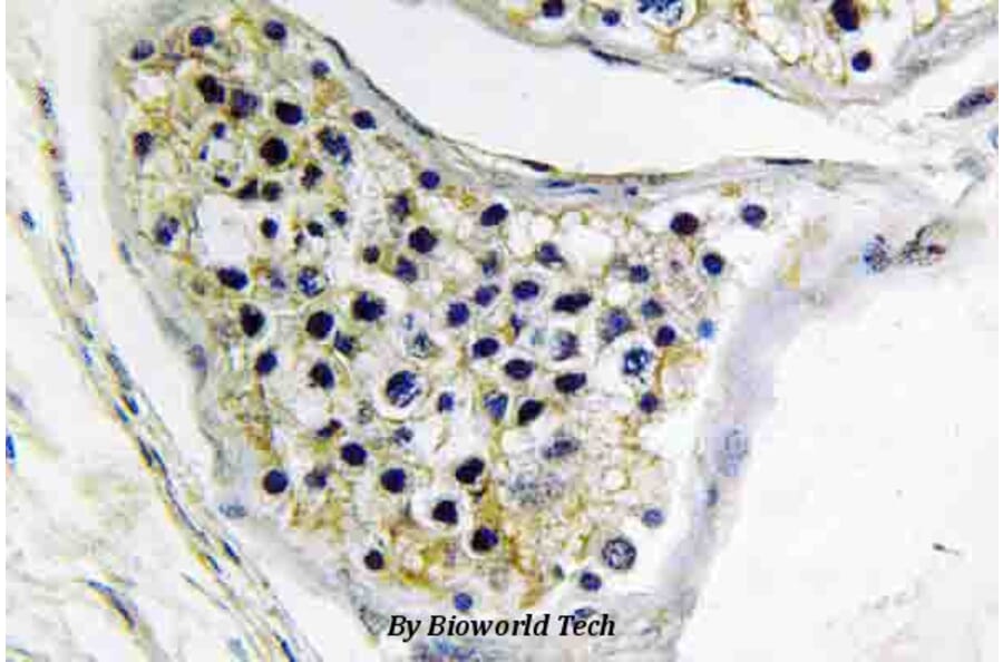 Anti-CNOT4 (E95) Antibody from Bioworld Technology (BS3829) - Antibodies.com