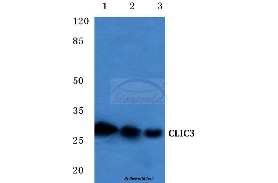 Anti-CLIC3 (F56) Antibody from Bioworld Technology (BS3832) - Antibodies.com
