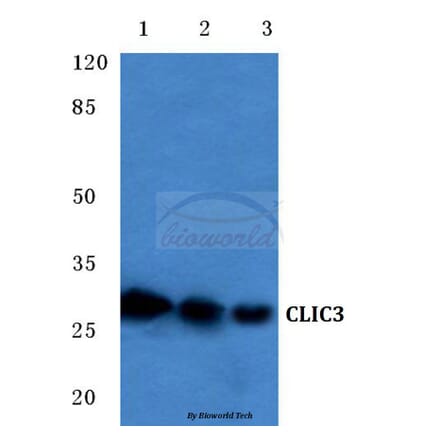 Anti-CLIC3 (F56) Antibody from Bioworld Technology (BS3832) - Antibodies.com